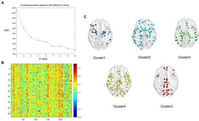 Structural–functional coupling abnormalities in temporal lobe epilepsy